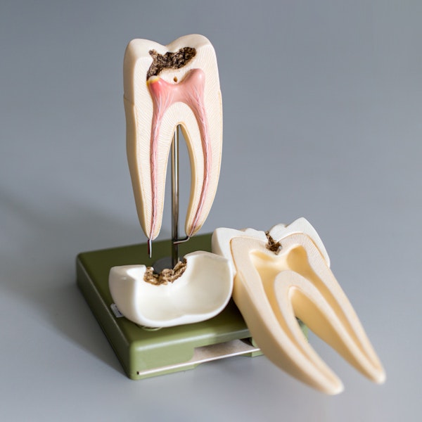 Root Canal model